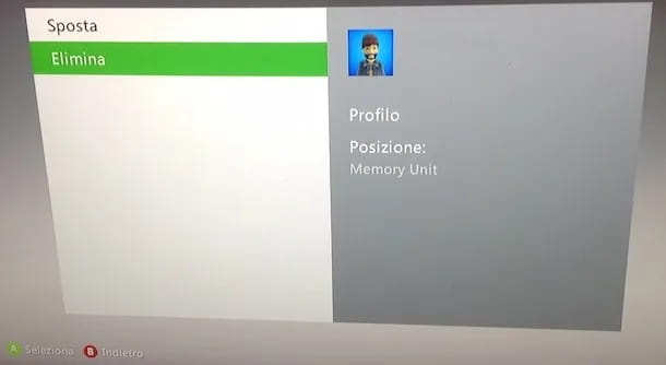 How to delete Xbox 360 profile