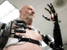This is Atom Touch, the world's first such advanced hand prosthesis