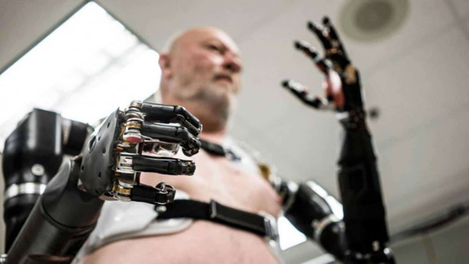 This is Atom Touch, the world's first such advanced hand prosthesis